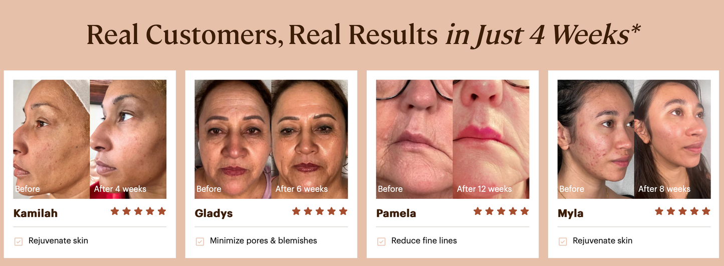 Plasma Skin Perfector