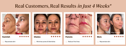 Plasma Skin Perfector